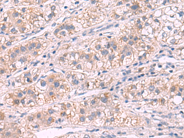 Rabbit Polyclonal Antibody to G6PC1