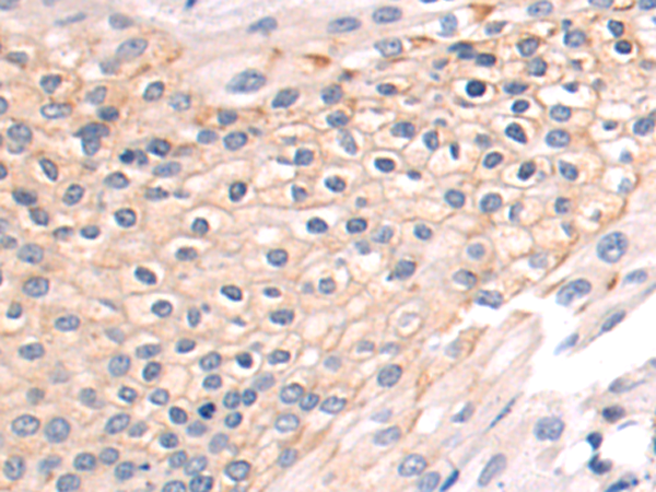 Rabbit Polyclonal Antibody to TJP1