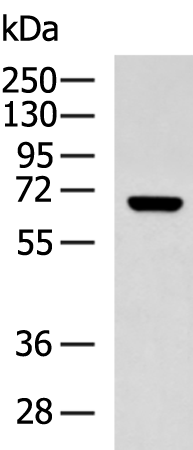 Rabbit Polyclonal Antibody to KCNN2