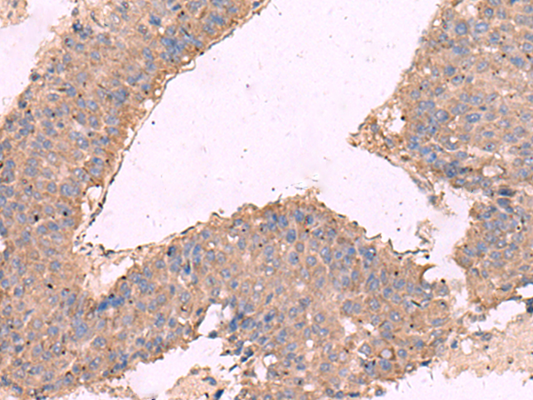 Rabbit Polyclonal Antibody to KCNN3