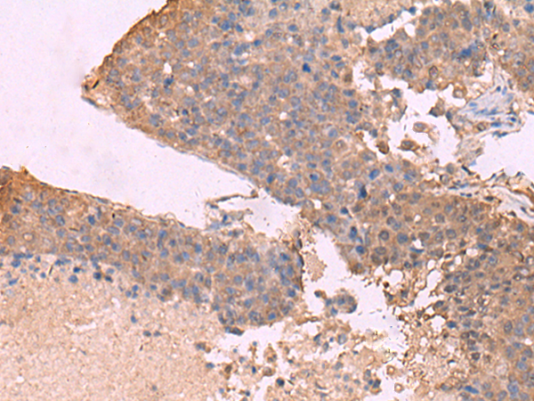Rabbit Polyclonal Antibody to KCNU1