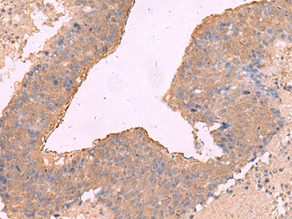 Rabbit Polyclonal Antibody to NIPSNAP1