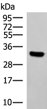 Rabbit Polyclonal Antibody to KCTD7