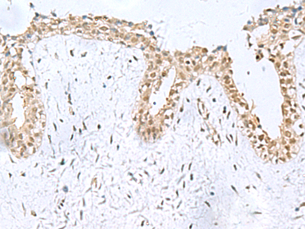 Rabbit Polyclonal Antibody to KDM2B