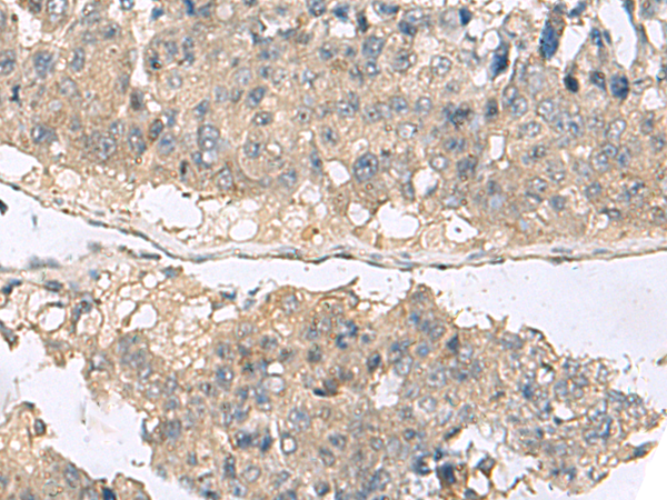 Rabbit Polyclonal Antibody to RBFOX1