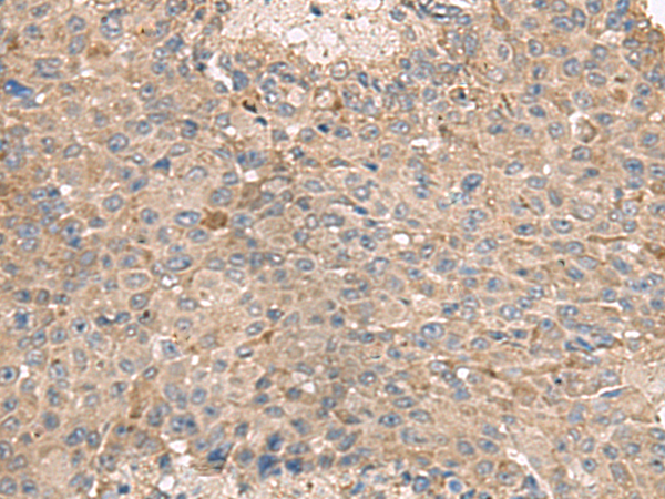 Rabbit Polyclonal Antibody to ABCA10