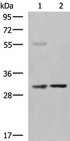 Rabbit Polyclonal Antibody to KHK