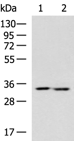 Rabbit Polyclonal Antibody to FN3KRP