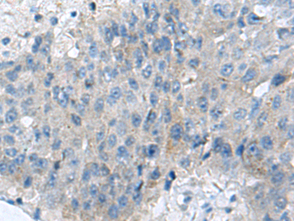 Rabbit Polyclonal Antibody to KIAA0556