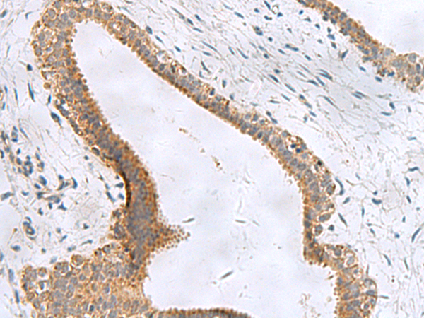 Rabbit Polyclonal Antibody to CEMIP