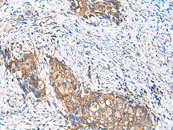 Rabbit Polyclonal Antibody to CAMSAP3