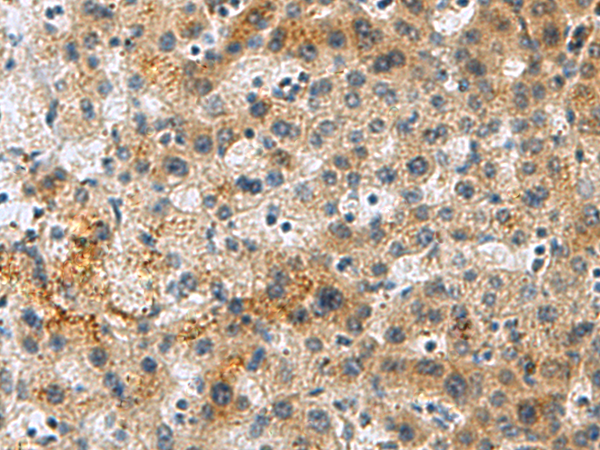 Rabbit Polyclonal Antibody to PLIN4