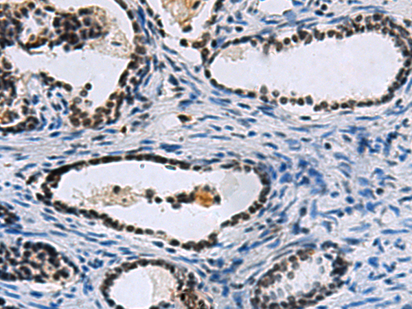 Rabbit Polyclonal Antibody to CCAR2