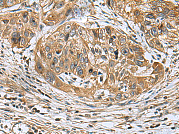 Rabbit Polyclonal Antibody to EARS2