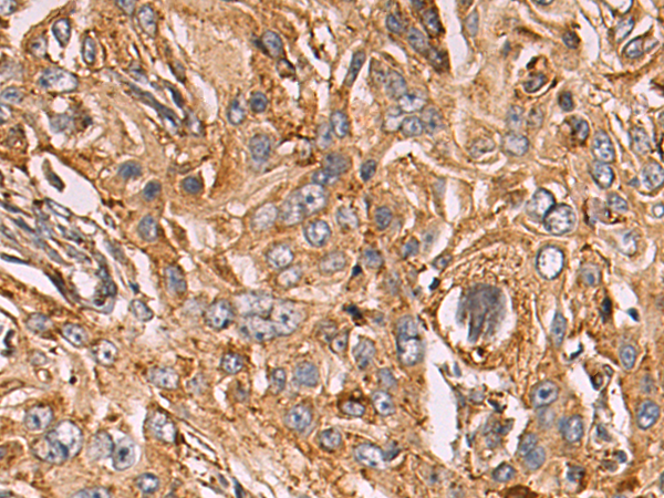 Rabbit Polyclonal Antibody to LAMP1