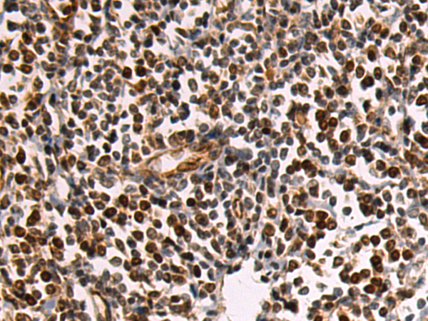 Rabbit Polyclonal Antibody to TOP1