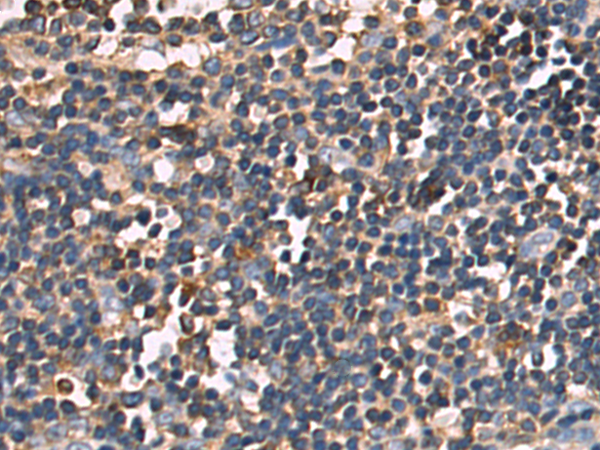 Rabbit Polyclonal Antibody to RPL7