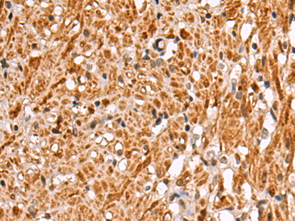 Rabbit Polyclonal Antibody to ESRP1
