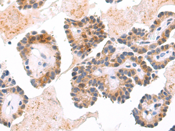 Rabbit Polyclonal Antibody to ARRDC4