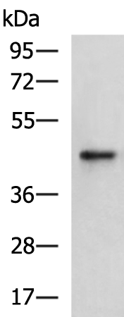 Rabbit Polyclonal Antibody to CKB