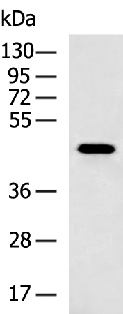 Rabbit Polyclonal Antibody to ALKBH5