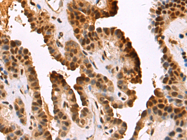 Rabbit Polyclonal Antibody to DNMT3B