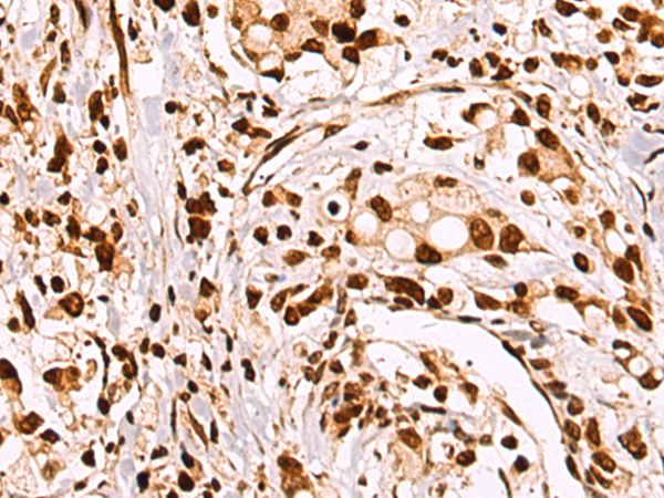Rabbit Polyclonal Antibody to HDAC7