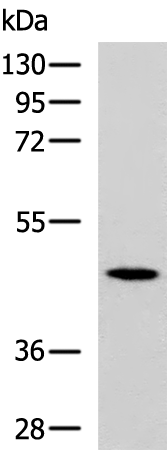 Rabbit Polyclonal Antibody to CKMT1A/CKMT1B