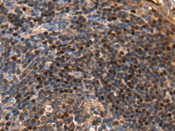 Rabbit Polyclonal Antibody to PAX5