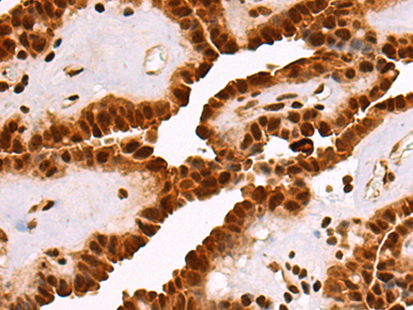 Rabbit Polyclonal Antibody to RBMS1