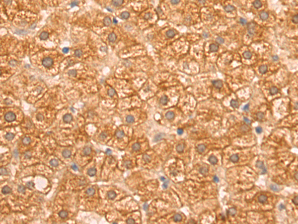 Rabbit Polyclonal Antibody to PIWIL2
