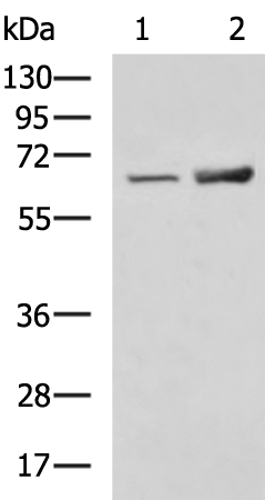 Rabbit Polyclonal Antibody to SLC28A1