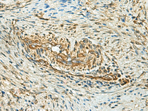 Rabbit Polyclonal Antibody to SELENOM