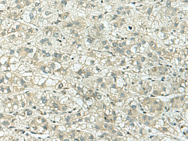 Rabbit Polyclonal Antibody to KIF3B