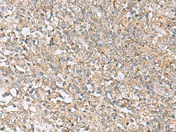 Rabbit Polyclonal Antibody to FERMT1