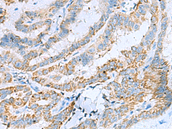 Rabbit Polyclonal Antibody to KIF5A