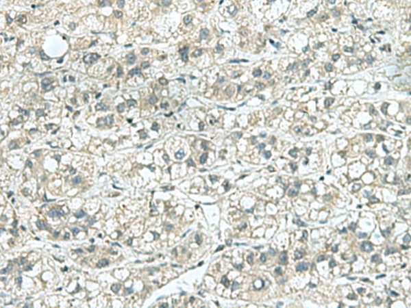 Rabbit Polyclonal Antibody to KIF5C