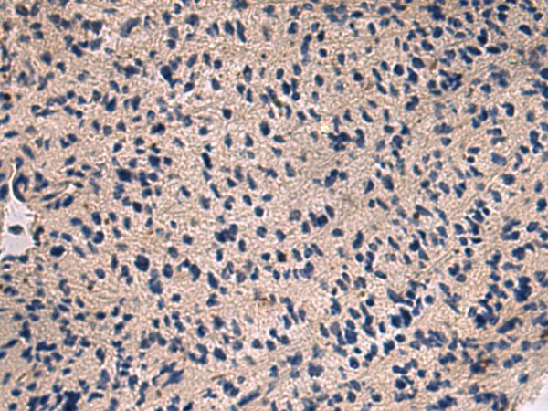 Rabbit Polyclonal Antibody to KNG1