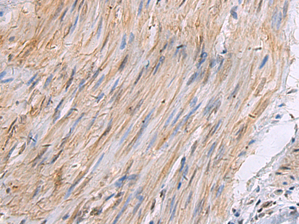 Rabbit Polyclonal Antibody to MUC4