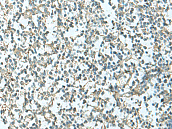 Rabbit Polyclonal Antibody to GNA12