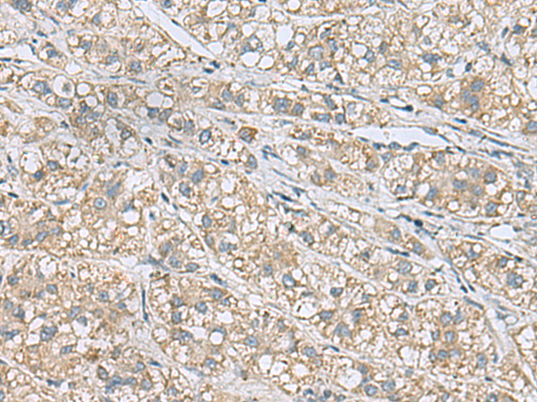 Rabbit Polyclonal Antibody to HSPB11