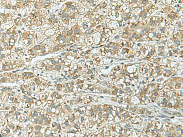 Rabbit Polyclonal Antibody to RAP1GAP