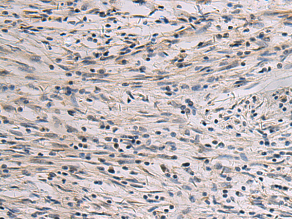 Rabbit Polyclonal Antibody to RELN