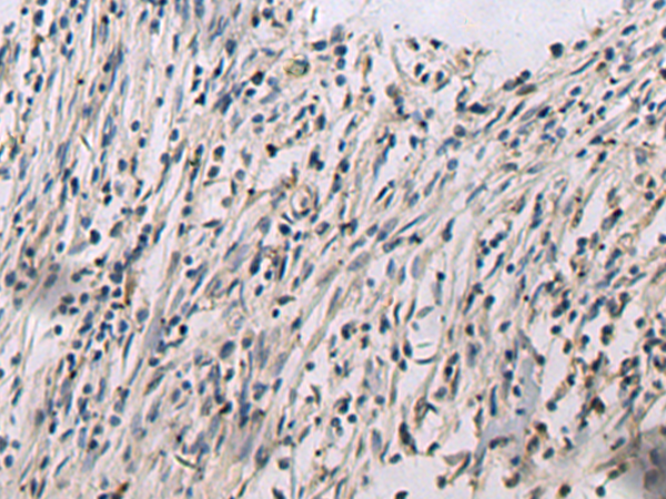 Rabbit Polyclonal Antibody to CNTF