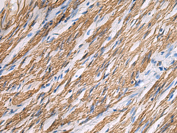 Rabbit Polyclonal Antibody to KCNH7