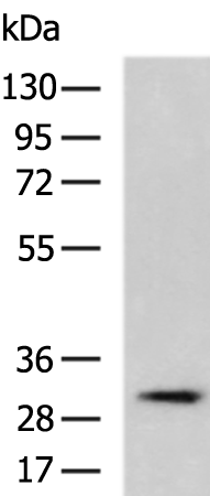 Rabbit Polyclonal Antibody to PLPP2