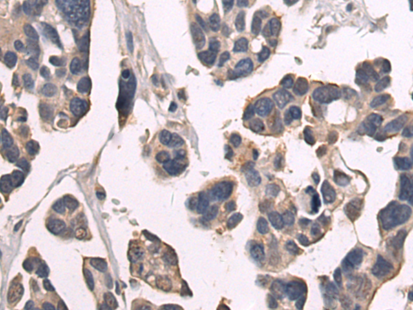 Rabbit Polyclonal Antibody to SREBF1