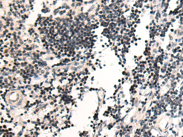 Rabbit Polyclonal Antibody to XRCC1