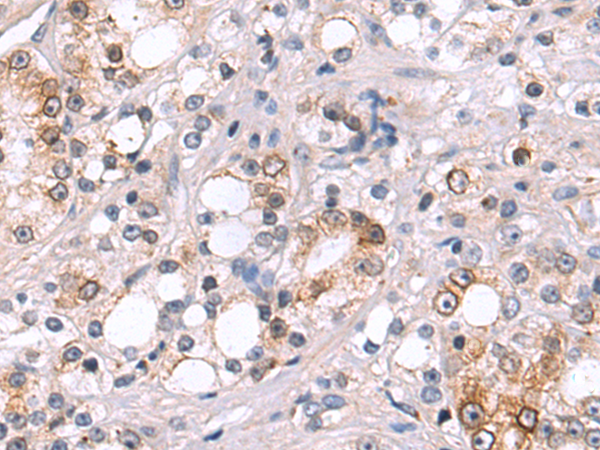 Rabbit Polyclonal Antibody to FLT1