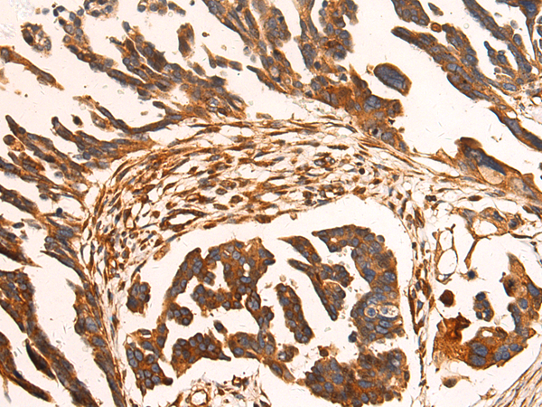 Rabbit Polyclonal Antibody to TRIM38